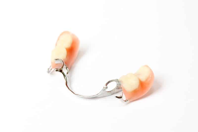 Removable Partial Dentures