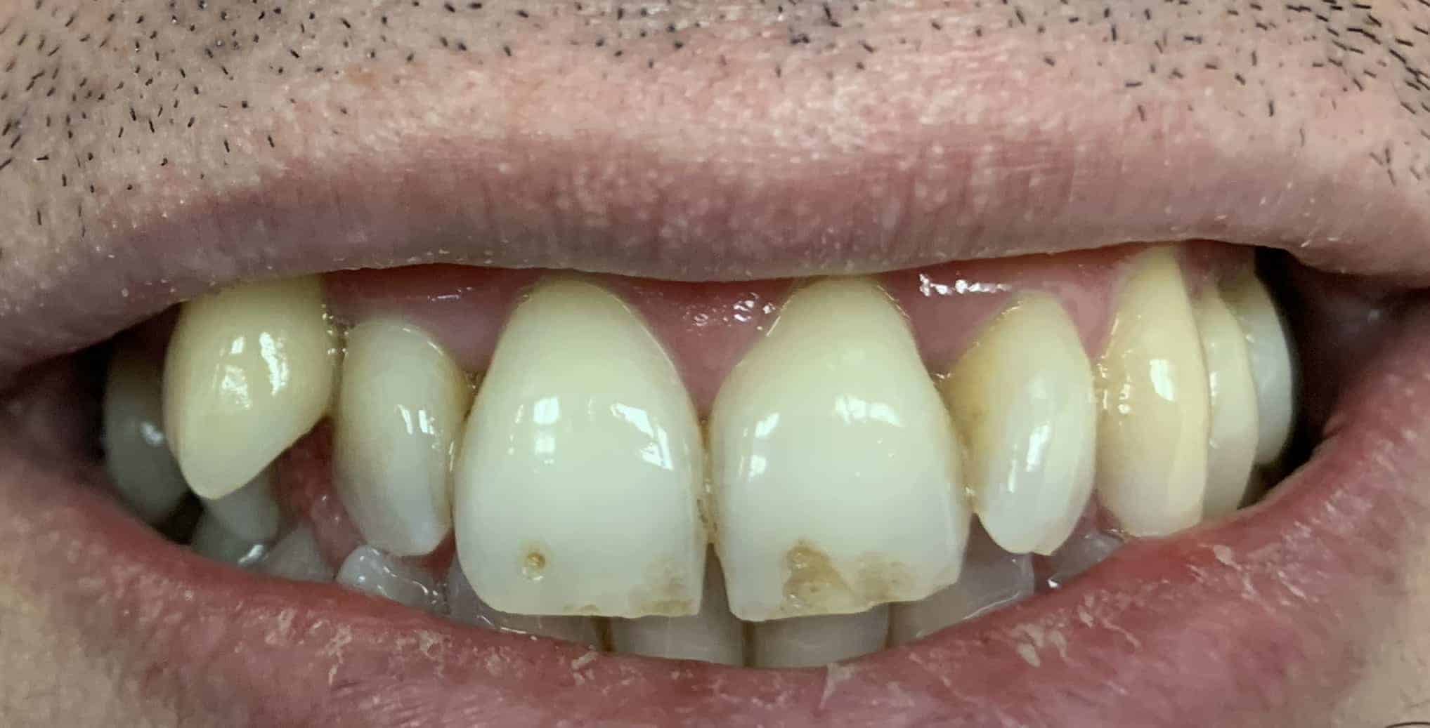 SIMPLE COSMETIC DENTAL CARE